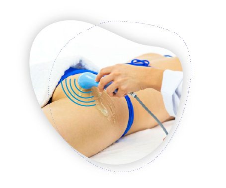 aplicacao-tecarterapia-estetica-intima aplicacao-tecarterapia-estetica-intima