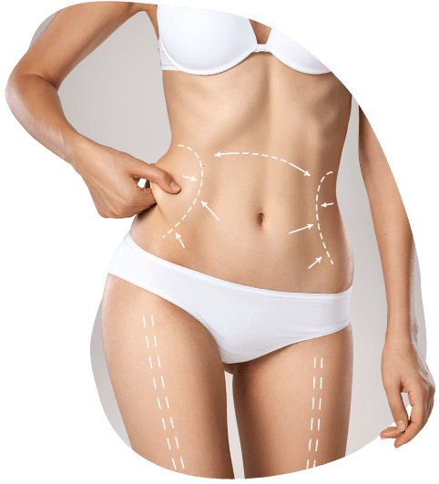 Acelere a recuperação pós-cirurgia plástica! Acelere a recuperação pós-cirurgia plástica!