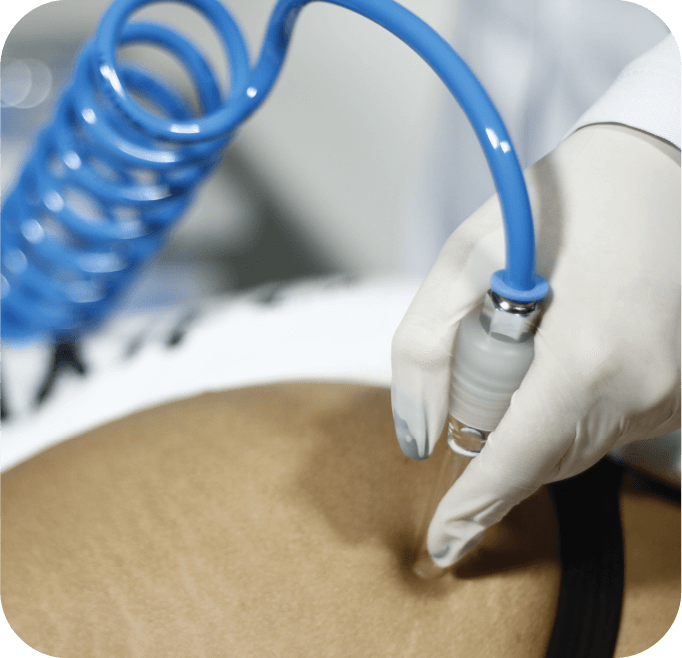 Vacuoterapia Vacuoterapia