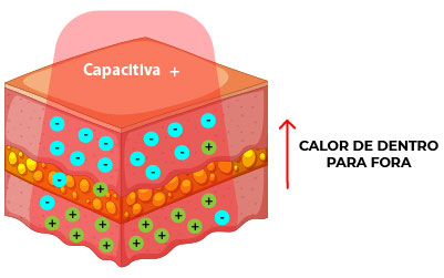 Eletrodos Capacitivos Eletrodos Capacitivos